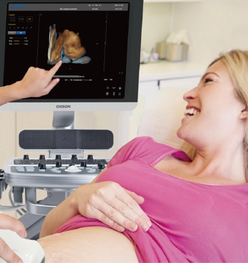 kvalita 3D ultrazvuku