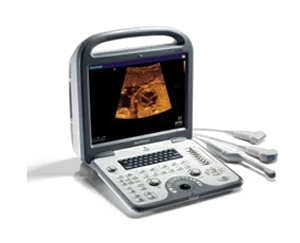 Prenosný ultrazvukový prístroj Sonoscape A6