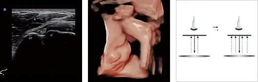 kvalitný 3D ultrazvuk